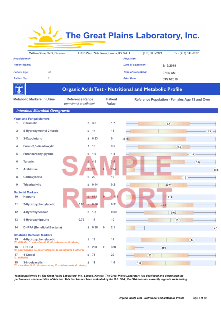 Organic Acids Test The Functional Perspective
