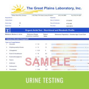 Order Urine Organic Acids Testing